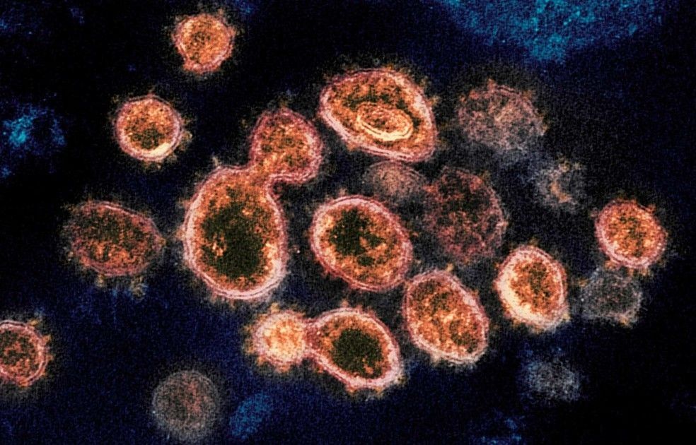 Variante brasileira do coronavirus é mais transmissível que outras encontradas no país, avalia pesquisador da Fiocruz