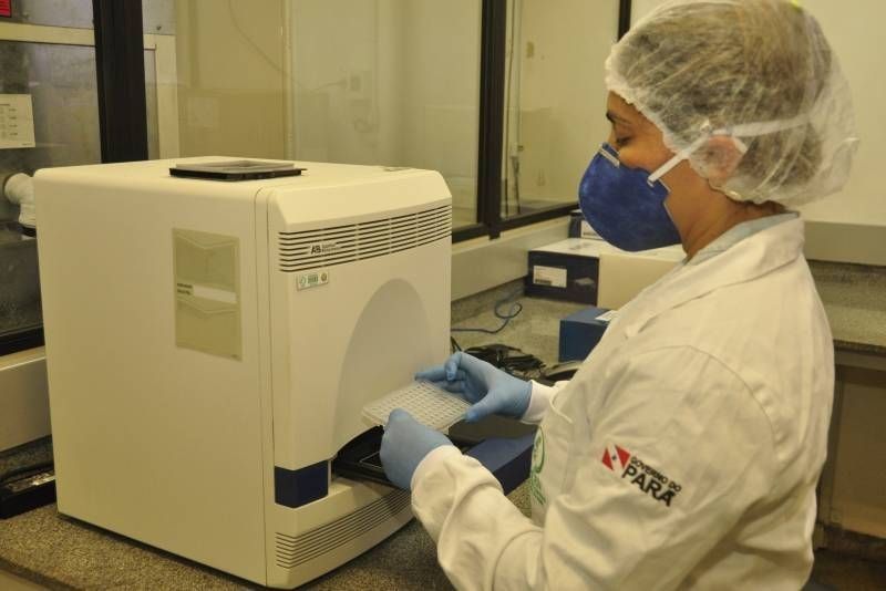 Pesquisadores no PA desenvolvem projeto que padroniza e valida técnicas para detecção de anticorpos do novo Coronavírus