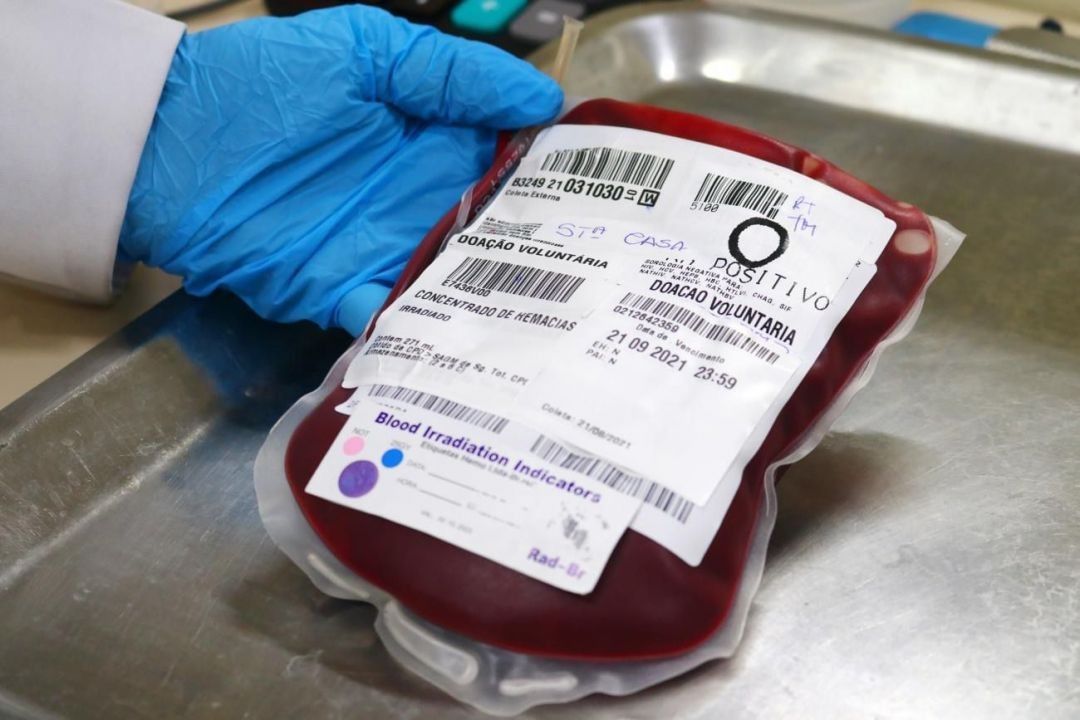 Com doença rara, mulher paraense precisa de 531 bolsas de sangue para sobreviver após parto