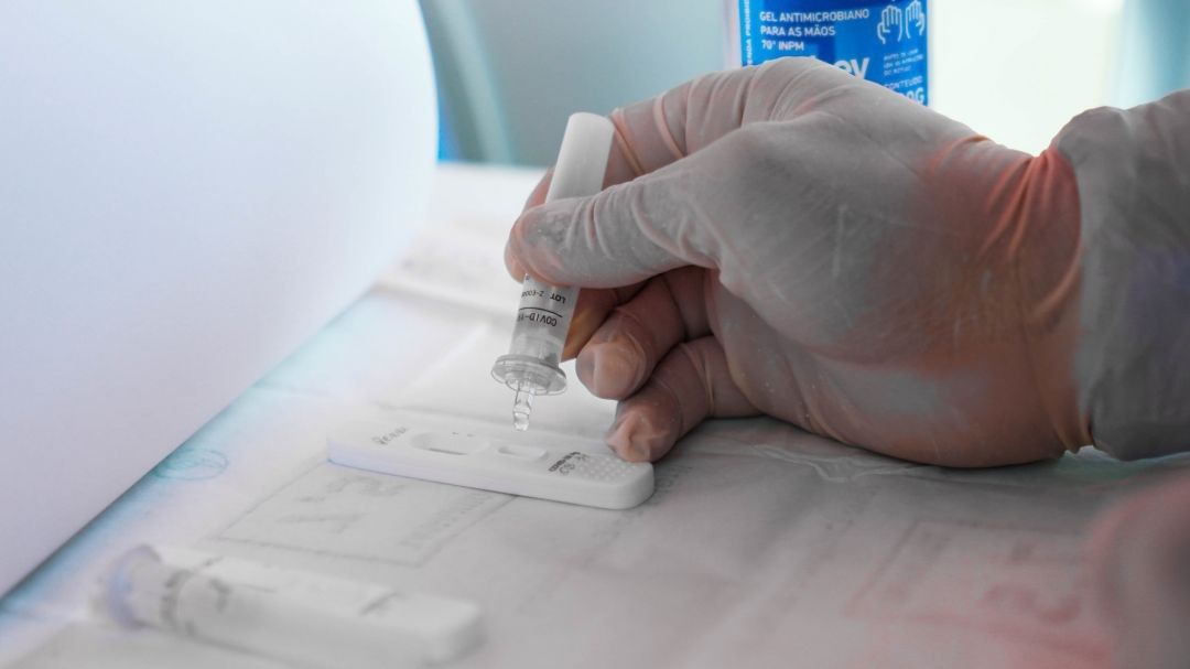 Para evitar superlotação, Macapá altera horário de realização de testes para Covid-19