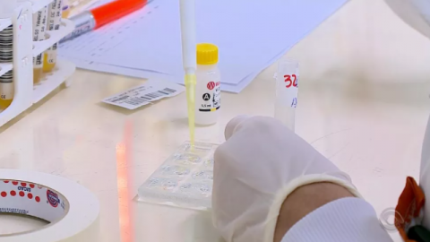 Toxoplasmose congênita assintomática em recém-nascidos